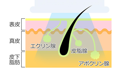 ミラドライには、エクリン腺を破壊し多汗症を治療する効果がある。