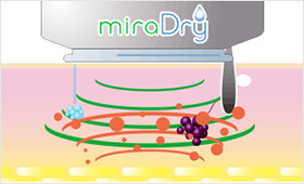 ミラドライの仕組み03 わきが・多汗症の原因となる汗腺の破壊