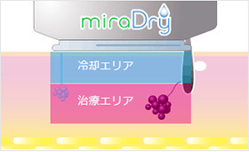 ミラドライの仕組み04 冷却機能でわきの皮膚を保護